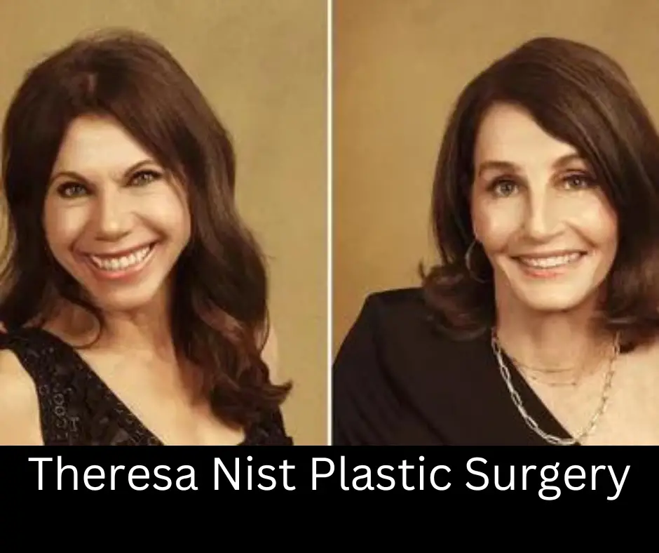 Theresa Nist Plastic Surgery-Has Theresa From Golden Bachelor Had Plastic Surgery?