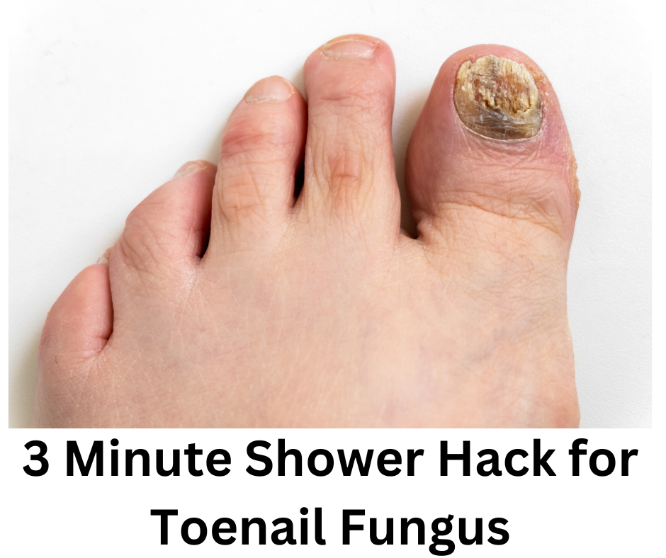 3 Minute Soak For Toenail Fungus The 3 Minute Shower Hack for Toenail Fungus: Kerassentials Review
