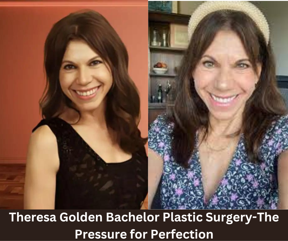 Theresa Golden Bachelor Plastic Surgery