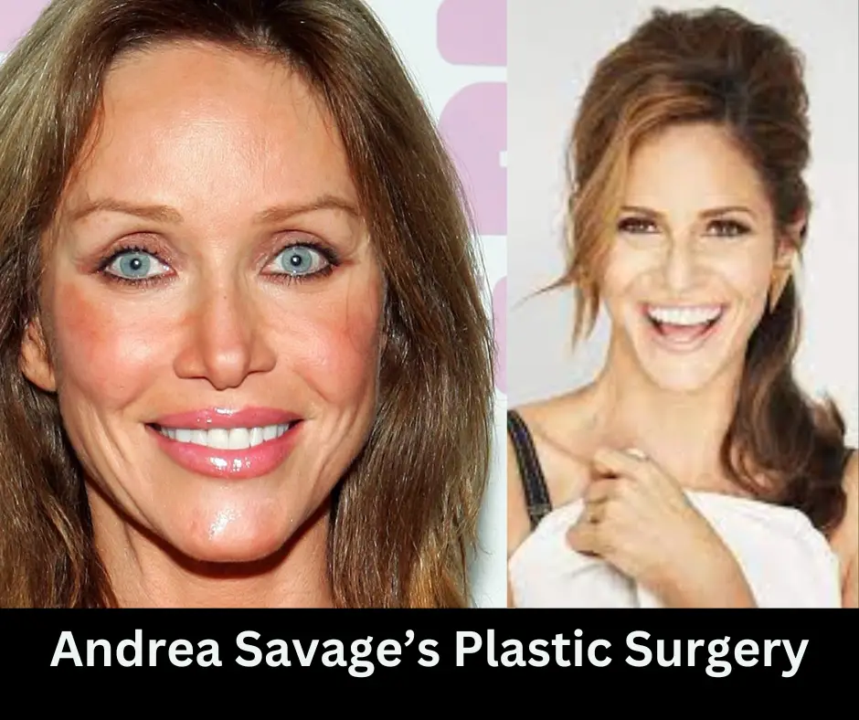 Andrea Savage Plastic Surgery