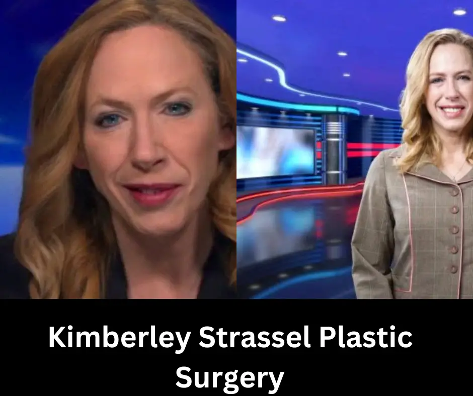 Kimberley Strassel Plastic Surgery