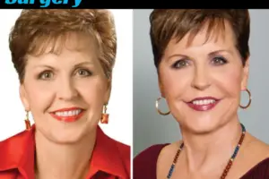 Joyce Meyer Plastic Surgery