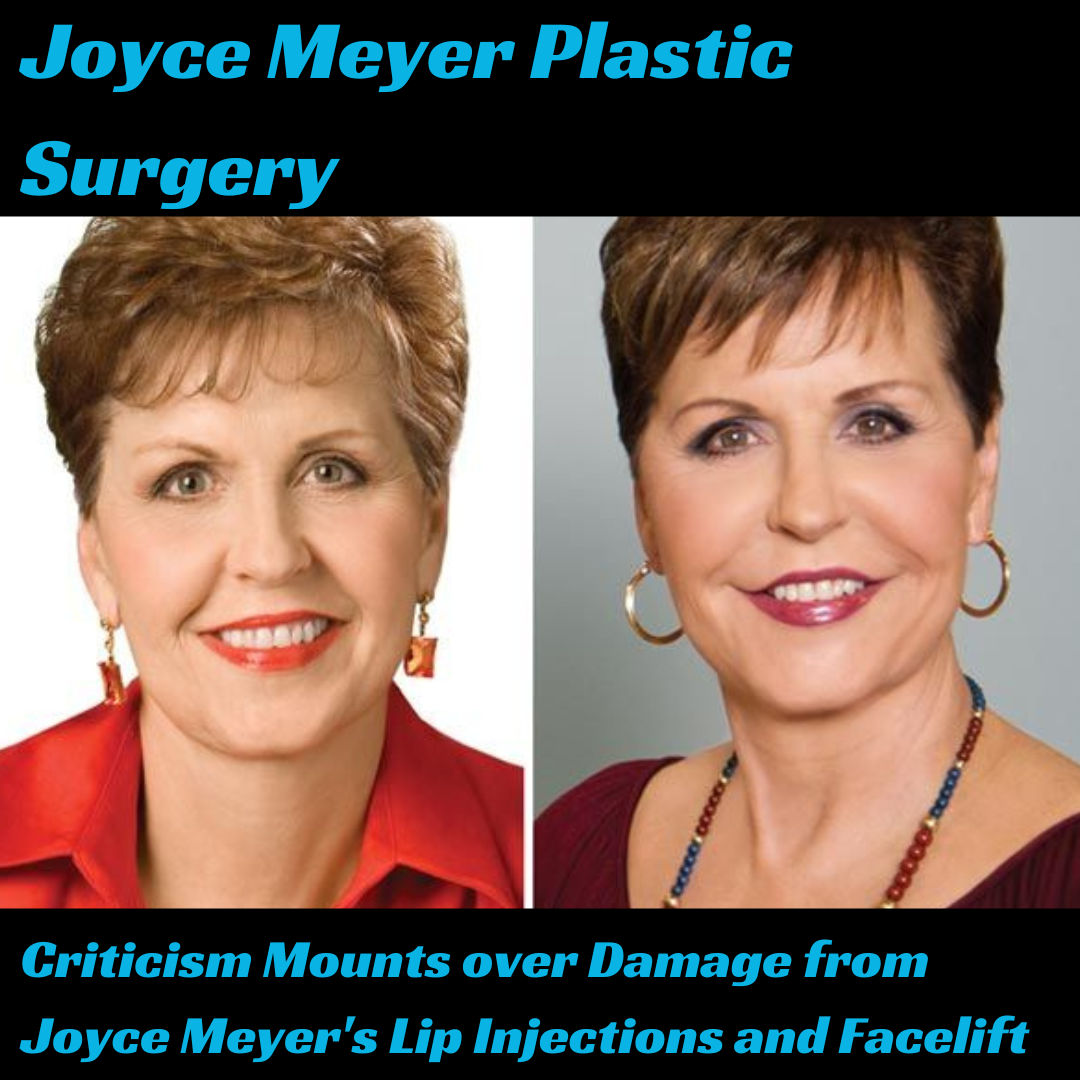 Joyce Meyer Plastic Surgery Journey Before and After - weightlasting.com