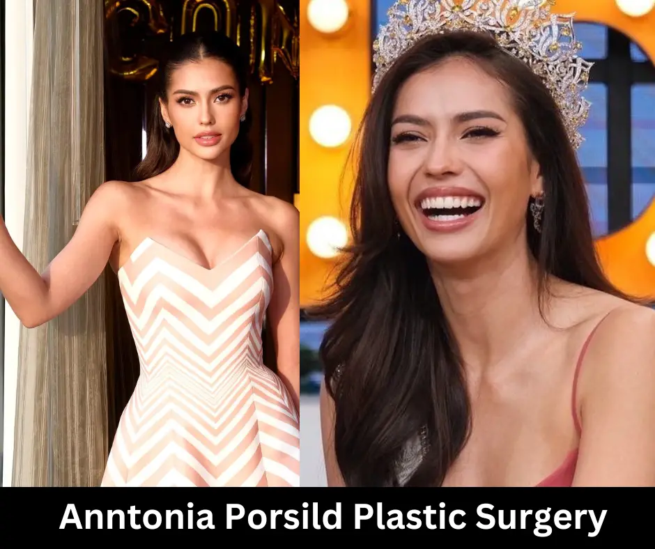 Anntonia Porsild Plastic Surgery