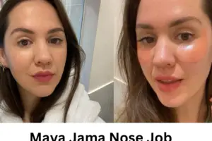 Maya Jama Nose Job