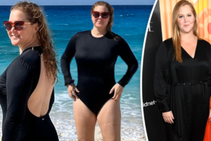 Amy Schumer Weight Loss